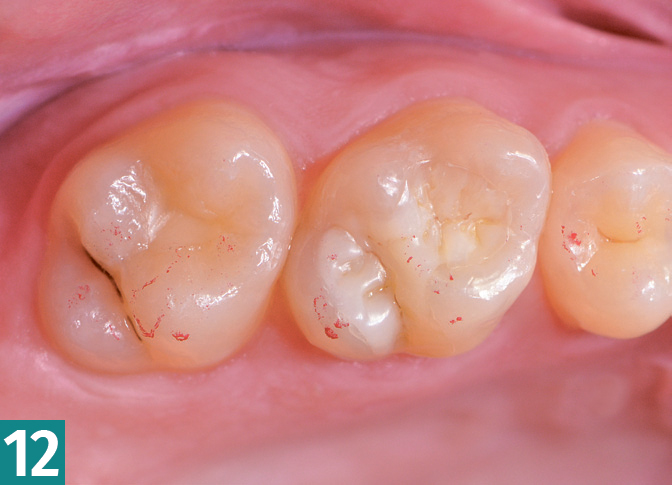 Реставрация DMG Constic - этап 12